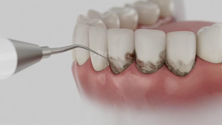 Trusted Dental Veneers service in Stockbridge, MI - Dentist Open Now